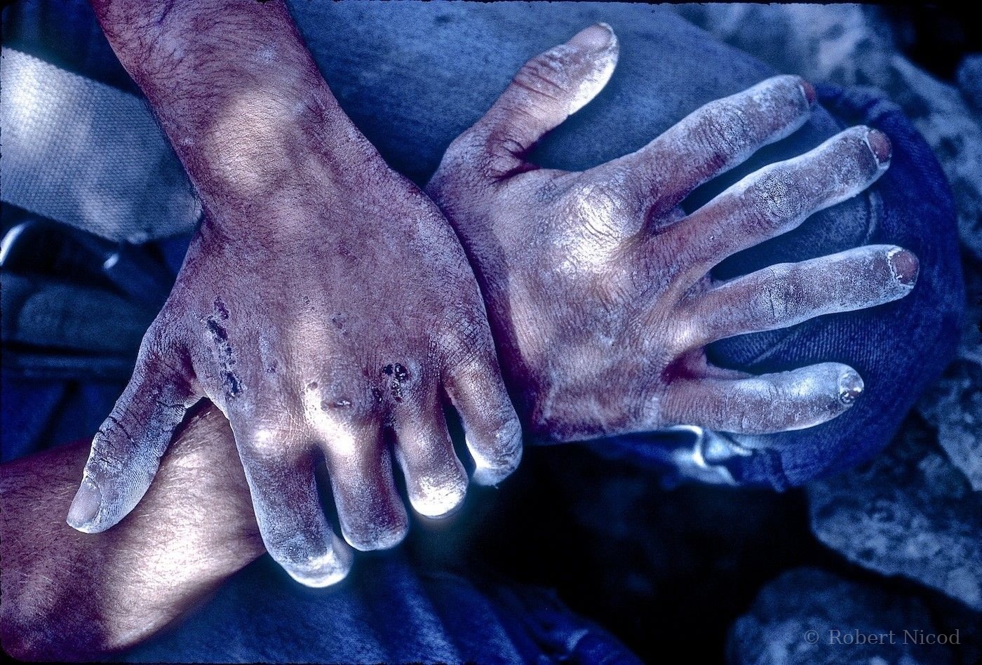 Escalade — Main de Patrick Bestagno, après 300 m de verrouillage en fissure, 1977