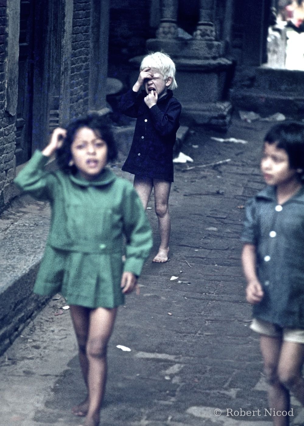 Reportage Népal 1977 — Enfant albinos, moqué comme ailleurs dans le monde, Katmandou 1977